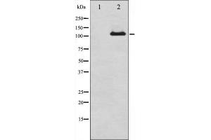 Western blot analysis of Progesterone Receptor expression in whole cell lysates,The lane on the left is treated with the antigen-specific peptide. (Progesterone Receptor antibody)