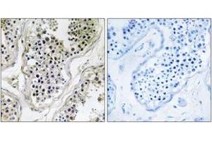 Immunohistochemistry analysis of paraffin-embedded human testis tissue, using ATXN7L1 Antibody. (ATXN7L1 antibody  (AA 441-490))