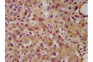 IHC image of ABIN7174623 diluted at 1:300 and staining in paraffin-embedded human liver tissue performed on a Leica BondTM system. (UGT1A1 antibody  (AA 395-482))