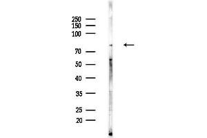Western blot analysis of lysates from Rat brain, using EMR2 Antibody at 1/1000 dilution.
