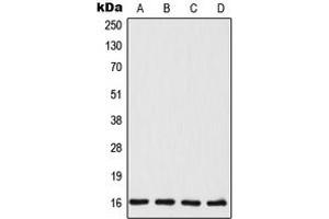 Western blot analysis of TSC22 expression in MCF7 (A), HeLa (B), mouse liver (C), rat liver (D) whole cell lysates. (TSC22D1 antibody  (C-Term))