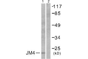 Western blot analysis of extracts from LOVO cells, using JM4 antibody (#C0238).