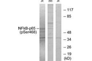 Western blot analysis of extracts from Jurkat cells and 293 cells, using NF-kappaB p65 (Phospho-Ser468) Antibody. (NF-kB p65 antibody  (pSer468))