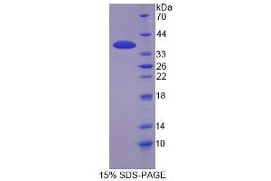 Image no. 1 for Inositol Hexakisphosphate Kinase 1 (IP6K1) (AA 1-300) protein (His tag) (ABIN4989335)