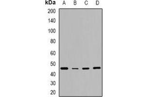 Western blot analysis of CD240d expression in HeLa (A), NIH3T3 (B), mouse brain (C), rat brain (D) whole cell lysates. (RHD antibody)
