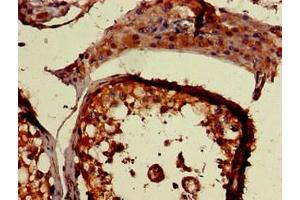 Immunohistochemistry of paraffin-embedded human testis tissue using ABIN7142049 at dilution of 1:100 (PLCD1 antibody  (AA 419-653))