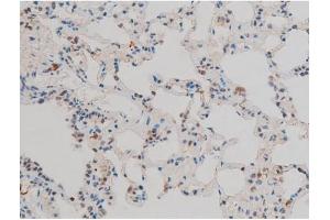 ABIN6267411 at 1/200 staining Rat lung tissue sections by IHC-P. (JunD antibody  (pSer255))