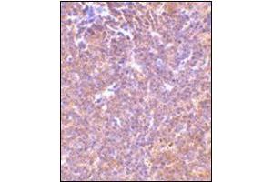 Immunohistochemistry of PAK2 in mouse spleen tissue with this product at 10 μg/ml. (PAK2 antibody  (C-Term))