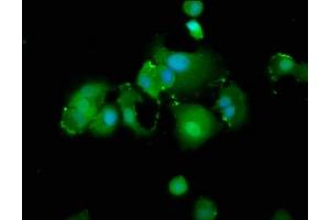 Immunofluorescence staining of MCF-7 cells with ABIN7172027 at 1:166, counter-stained with DAPI. (TXNIP antibody  (AA 299-381))