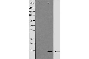 Western blot analysis of Trefoil factor 2（TFF2） expression in HeLa cells,The lane on the left is treated with the antigen-specific peptide. (Trefoil Factor 2 antibody  (Internal Region))