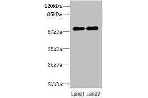Western blot All lanes: TRMT6 antibody at 4 μg/mL Lane 1: U251 whole cell lysate Lane 2: HepG2 whole cell lysate Secondary Goat polyclonal to rabbit IgG at 1/10000 dilution Predicted band size: 56, 45, 41, 37 kDa Observed band size: 56 kDa (TRMT6 antibody  (Catalytic Subunit))