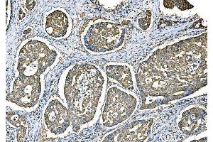 IHC analysis of Ezrin/EZR using anti-Ezrin/EZR antibody (ABIN7603214).