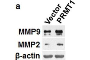Western Blotting (WB) image for anti-Matrix Metalloproteinase 2 (MMP2) antibody (ABIN2855854)