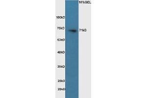 Raji lysates probed with Anti- Pro-Neuregulin Polyclonal Antibody, Unconjugated  at 1:5000 for 90 min at 37˚C (Neuregulin 1 antibody  (AA 221-320))