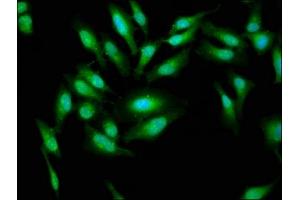 Immunofluorescence staining of Hela cells with ABIN7143628 at 1:33, counter-stained with DAPI.