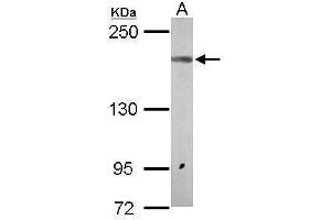 WB Image Sample (50 ug of whole cell lysate) A: Mouse brain 5% SDS PAGE antibody diluted at 1:1000 (NMDAR2A antibody  (N-Term))