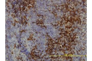 Immunoperoxidase of monoclonal antibody to LY6H on formalin-fixed paraffin-embedded human tonsil tissue. (LY6H antibody  (AA 26-140))