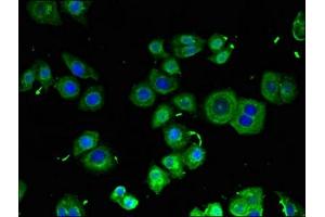 Immunofluorescent analysis of PC-3 cells using ABIN7167417 at dilution of 1:100 and Alexa Fluor 488-congugated AffiniPure Goat Anti-Rabbit IgG(H+L) (FIP200 antibody  (AA 1544-1594))