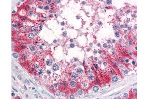 Anti-SRPX2 antibody IHC of human testis. (SRPX2 antibody  (Internal Region))