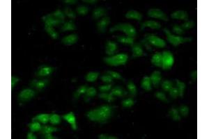 IHC-P analysis of Human HeLa cells, with FITC staining. (CAPNL1 antibody  (AA 387-694))
