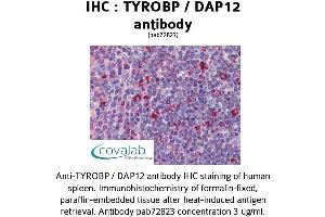 Image no. 1 for anti-TYRO Protein tyrosine Kinase Binding Protein (TYROBP) (Internal Region) antibody (ABIN1740506) (TYROBP antibody  (Internal Region))