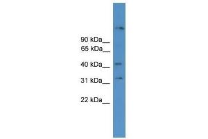 SYT11 antibody used at 0. (SYT11 antibody  (N-Term))