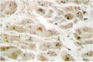 Immunohistochemistry: LIMK2 antibody staining of Paraffin-Embedded Human brain tissue. (LIMK2 antibody)