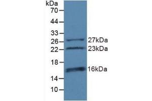 Detection of Recombinant CHD3, Human using Polyclonal Antibody to Chromodomain Helicase DNA Binding Protein 3 (CHD3) (CHD3 antibody  (AA 1551-1742))