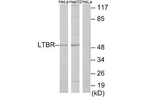 Western blot analysis of extracts from HeLa cells and HepG2 cells, using LTBR antibody. (LTBR antibody  (N-Term))