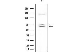 anti-Insulin-Like Growth Factor 2 mRNA Binding Protein 3 (IGF2BP3) antibody