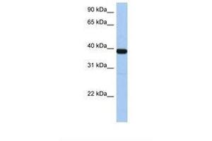Image no. 1 for anti-Zinc Finger Protein 781 (ZNF781) (N-Term) antibody (ABIN6739309)