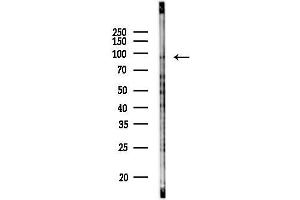 anti-Vacuolar Protein Sorting 41 Homolog (VPS41) (Internal Region) antibody