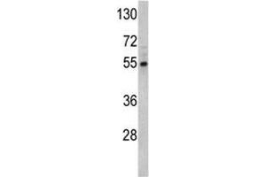 Western blot analysis of Fascin antibody and Y79 lysate. (Fascin antibody  (AA 322-350))