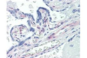IHC Analysis: Human placenta tissue stained with PDGF receptor beta, mAb (42G12) at 20μg/ml. (PDGFRB antibody)