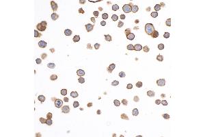anti-Epithelial Cell Adhesion Molecule (EPCAM) (AA 264-314) antibody
