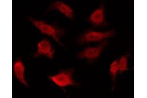 ABIN6276017 staining 293 by IF/ICC. (GPR156 antibody  (Internal Region))
