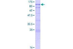 Bromodomain Adjacent To Zinc Finger Domain, 2B (BAZ2B) (AA 1-643) protein (GST tag)