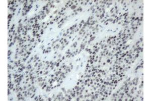 Image no. 1 for anti-Splicing Factor 3a, Subunit 1 (SF3A1) (AA 249-568) antibody (ABIN1491272) (SF3A1 antibody  (AA 249-568))