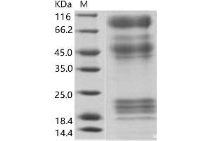 Zaire Ebola Virus Envelope Glycoprotein (ZEBOV GP) protein (His tag)