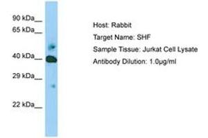 Image no. 1 for anti-Src Homology 2 Domain Containing F (SHF) (AA 22-71) antibody (ABIN6749970) (SHF antibody  (AA 22-71))