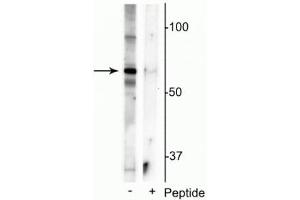 Western blot of mouse whole brain lysate showing specific immunolabeling of the ~55 kDa truncated MeCP2 protein phosphorylated at Ser421 in the first lane (-). (MECP2 antibody  (pSer421))