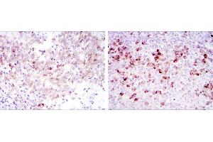 Immunohistochemical analysis of paraffin-embedded cervical cancer tissues (left) and tonsil tissues (right) using CTTN mouse mAb with DAB staining. (Cortactin antibody)