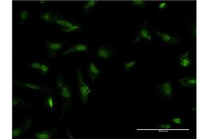 Immunofluorescence of monoclonal antibody to HDGF on HeLa cell. (HDGF antibody  (AA 184-240))