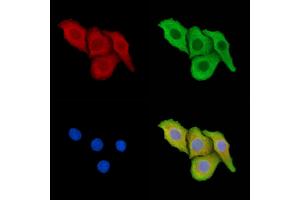 ABIN7095319 and ABIN7099376 staining Hela cells by IF/ICC.