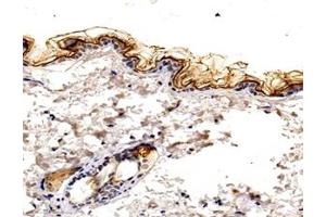Immunohistochemistry analysis of paraffin-embedded mouse skin using,KLK7 (ABIN7074396) at dilution of 1: 1600 (Kallikrein 7 antibody)