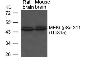Western blot analysis of extracts from Rat and Mouse brain tissue using MEK5(phospho-Ser311/ Thr315) Antibody. (MAP2K5 antibody  (pSer311, pThr315))