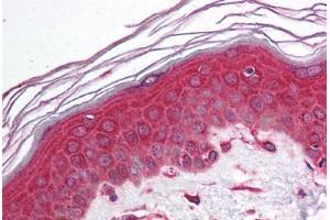 Human Skin (formalin-fixed, paraffin-embedded) stained with NFKBIA antibody ABIN214129 at 5 ug/ml followed by biotinylated goat anti-rabbit IgG secondary antibody ABIN481713, alkaline phosphatase-streptavidin and chromogen. (NFKBIA antibody  (N-Term))