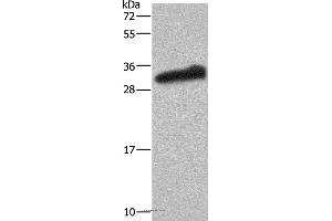 Western blot analysis of Human testis tissue, using GSTA3 Polyclonal Antibody at dilution of 1:250 (GSTA3 antibody)