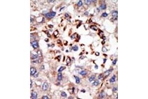 Image no. 2 for anti-Chromobox Homolog 8 (CBX8) (C-Term) antibody (ABIN357753) (CBX8 antibody  (C-Term))