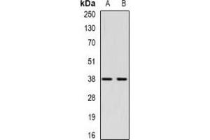 Western blot analysis of CTGF expression in Hela (A), HepG2 (B) whole cell lysates. (CTGF antibody)